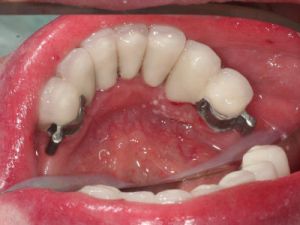 prace-kombinowane-na-zasuwach-1a