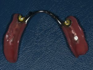 prace-kombinowane-na-zasuwach-1b