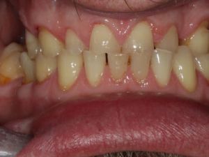 prace-kombinowane-na-zasuwach-2a