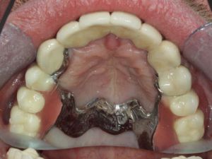 prace-kombinowane-na-zasuwach-2b