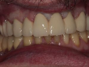 prace-kombinowane-na-zasuwach-2c