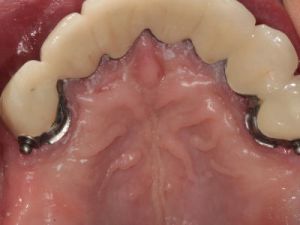 prace-kombinowane-na-zasuwach-2d