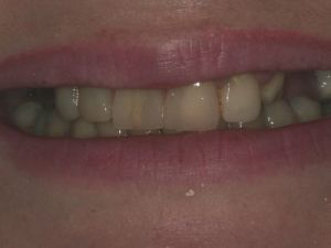 prace-kombinowane-na-zasuwach-3a