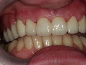 prace-kombinowane-na-zasuwach-3b