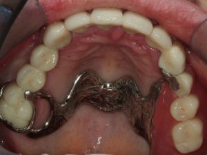 prace-kombinowane-na-zasuwach-3d