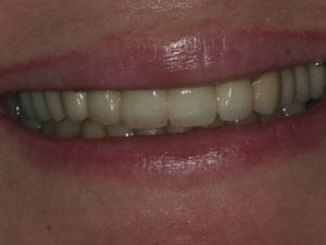 prace-kombinowane-na-zasuwach-3e