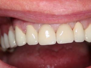 prace-kombinowane-na-zasuwach-4b